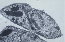 le protozoaire parasite responsable de la malaria : plasmodium falciparum