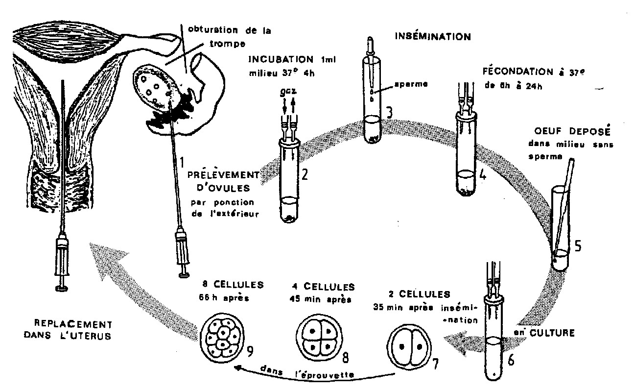 Procédé pour produire un bébé éprouvette